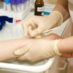 Проба Манту: коли вона потрібна?