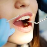 П'ять порад для здоров’я зубів та красивої усмішки